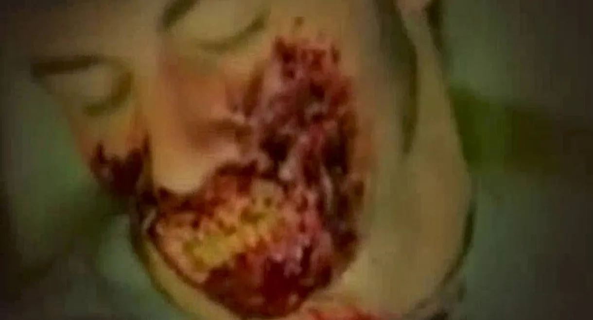 Corpses