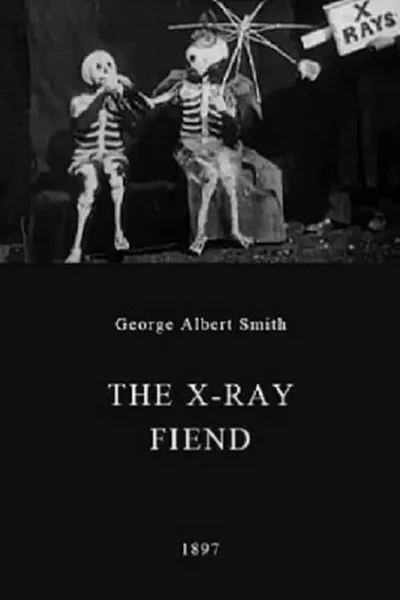 The X-Ray Fiend