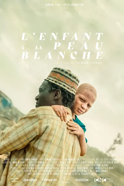 The Boy with White Skin
