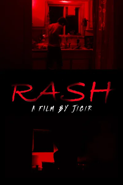 Rash